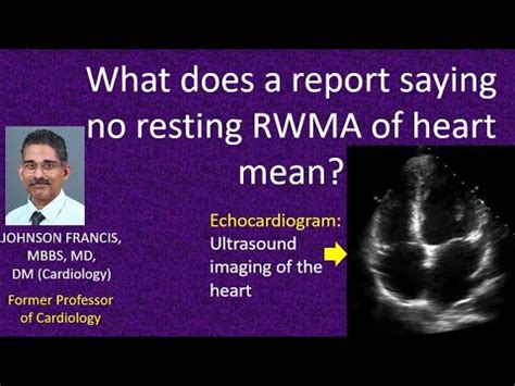 no resting rwma means.